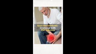 Knee #osteoarthritis treatment with #PRP Injection #recovery #askdrmanu