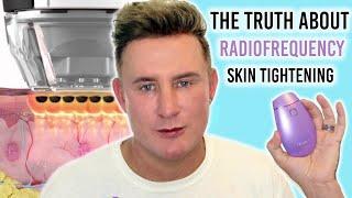 The Truth About Radiofrequency Skin Tightening | Facelift Without Surgery