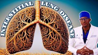 Interstitial Lung Disease and how it injures the Lung