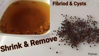 ADD THIS SEED SHRINK FIBRIOD & REMOVE CYSTS NATURALLY | STOP GROWTH OF FIBRIOD NATURALLY