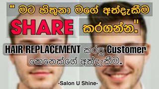 Customer Experience About Hair Replacement