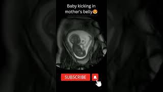 Baby kicks in mother's womb #motherandbaby #pregnancy