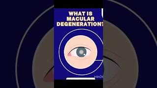 What is Macular Degeneration || Optometry With Shahid ||