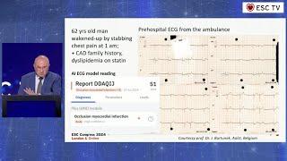 The ECG analysis of ischemia: tips and tricks for the insider (are there any...?) | ESC London 2024