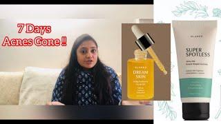 7 Days -Acnes Gone | Best Acne removing Skincare Products |@GLAMRSTV Review