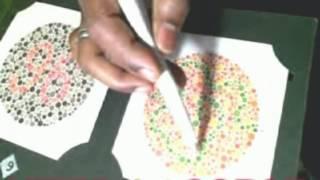 COLOR BLINDNESS CURE Dr RISHABH JAIN  +91-9425092329