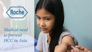 Hepatocellular carcinoma – the ‘silent killer’ | Part 2