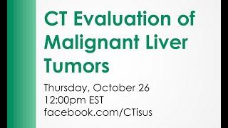 Facebook Live: CT Evaluation of Malignant Liver Tumors