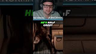 Is it NORMAL or ABNORMAL? 