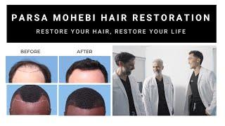 Confidence Redefined: Discover Our Hair Transplant Solutions at Parsa Mohebi Hair Restoration