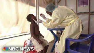 WHO declares global emergency as mpox virus spreads across Africa