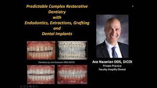 Webinar Replay: 11/10/20 Achieving Predictable Complex Restorative Dentistry - Dr. Ara Nazarian