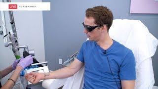 Laser Tattoo Removal LIVE SESSION at LaserAway 