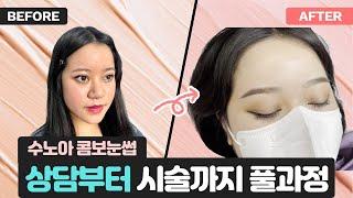 강남 수노아 콤보 눈썹 상담부터 시술까지!! Gangnam Soonoa Eyebrow Review (Ft.Foreigner eyebrows)