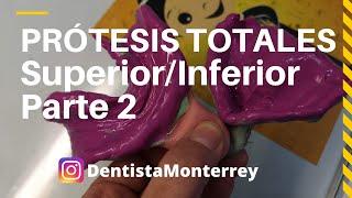 PASOS Prácticos #ProtesisTotales Parte2 Cucharillas /Impresión dental #Dentaduracompleta #dental