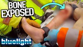 Bad Leg INJURY from Crash (Helicopter Rescue) | Air Ambulance ER | Blue Light: Police & Emergency