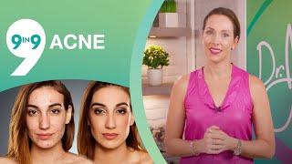 9 Hidden Secrets for Acne  : How to Get Rid Of Acne : Dr J9 - live