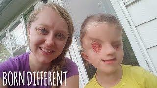 My Incredible Son With No Eyes | BORN DIFFERENT