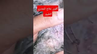 الاختراع أقوى علاج لجدري الطيور