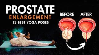Yoga for Prostate Problems | 13 Best Prostate Yoga Exercises #prostatecancer