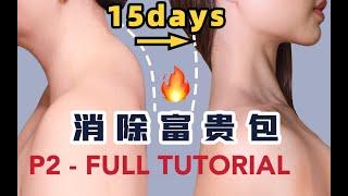 10 STEPS TO FIX DOWAGER’S HUMP (P2) 消除富贵包完整版跟练/15天缓解肩颈酸痛，预防颈椎病 Full tutorial