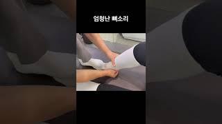 엄청난 발목 뼈소리 #도수치료 #뼈소리asmr #카이로프랙틱 #asmr