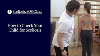How to Check Your Child for Scoliosis: Adams Forward Bending Test