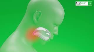 GeloTonsil® Gurgelgel – Jetzt geht's Halsschmerzen an die Gurgel