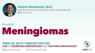 Meningiomas - Dr. Rodriguez (Hopkins) #NEUROPATH