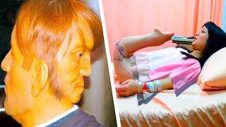 20 Real People With Extremely Weird Diseases