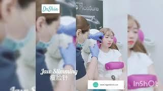 Jaw Slimming Botox 瘦脸针 肉毒杆菌 by DrShin Regen Clinic Penang