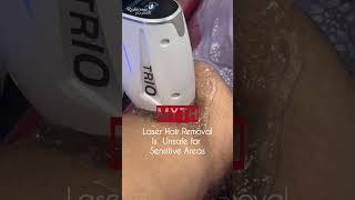 Myth: Laser Hair Removal Isn’t Safe for Sensitive Areas