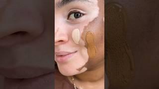 How to apply foundation with vitiligo skin | Onella using Fenty Beauty Foundation shades 110 and 420