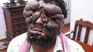 The Curious Case of Ravikumar - 3 Years Results!!