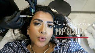 PRP Scalp | in Tamil | Vithya Hair and Makeup