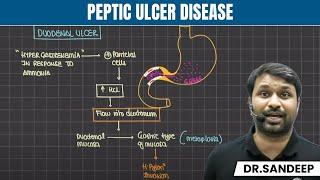 Peptic Ulcer Disease | Surgery | Bailey learned with Dr. Sandeep | PW MedEd