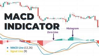 Free MACD Masterclass By Abhishek Dubey