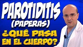 PAROTIDITIS o PAPERAS - ¿Qué pasa dentro del cuerpo de las personas que las padecen?