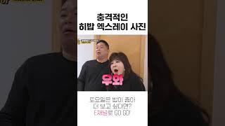 [#토밥좋아] 충격적인 히밥 엑스레이 사진 #Shorts