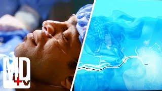 Doctors Remove Blood Clot The Brain Whilst Patient Is Awake | House M.D. | MD TV