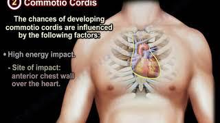 Sudden cardiac Death In Athletes - Everything You Need To Know - Dr. Nabil Ebraheim