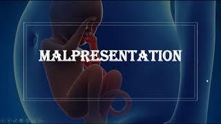 Malpresentation/Breech presentation - types of breech, causes of breech, investigation