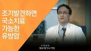 조기발견하면 국소치료 가능한 유방암 - (2011.3.26_366회 방송)_조기검진으로 암을 이겨낸 사람들 ②여성암