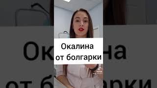 Что делать,если в глаз попала окалина от болгарки?