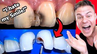 Real Orthodontist Reacts! Crazy Dental Transformation Makes Patient Smile Again!