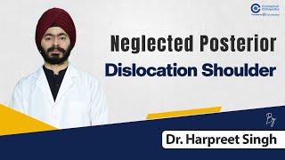 Neglected Posterior Dislocation shoulder by Dr. Harpreet Singh | Orthopedic Residency