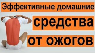 Первая помощь при ожогах в домашних условиях. Эффективное средство от ожогов.