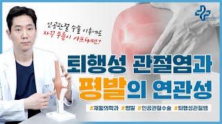 인공관절 수술 이후에도 자꾸 무릎이 아프다면? (평발과 퇴행성 무릎 관절염)