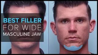 Using Dermal Fillers To Create a Masculine Jaw at Mabrie Facial Institute