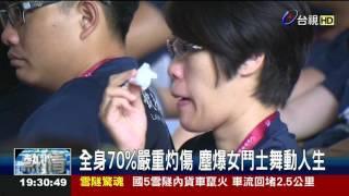 全身70%嚴重灼傷塵爆女鬥士舞動人生